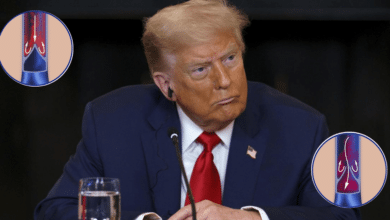 Trump enfrenta problemas venosos a los 79 años, confirma la Casa Blanca