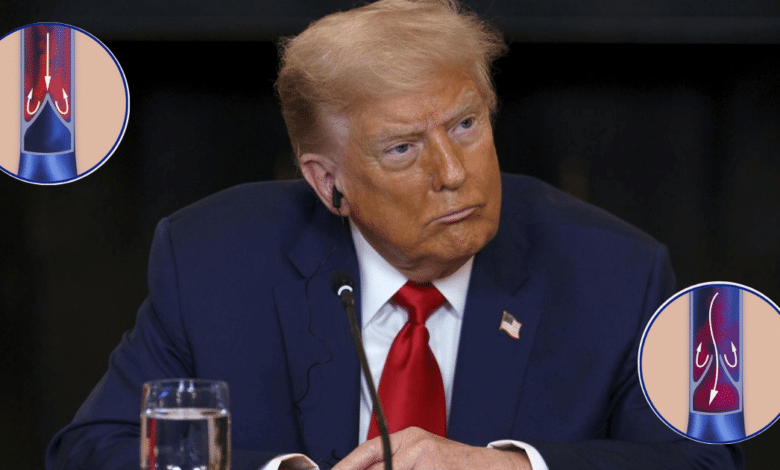 Trump enfrenta problemas venosos a los 79 años, confirma la Casa Blanca
